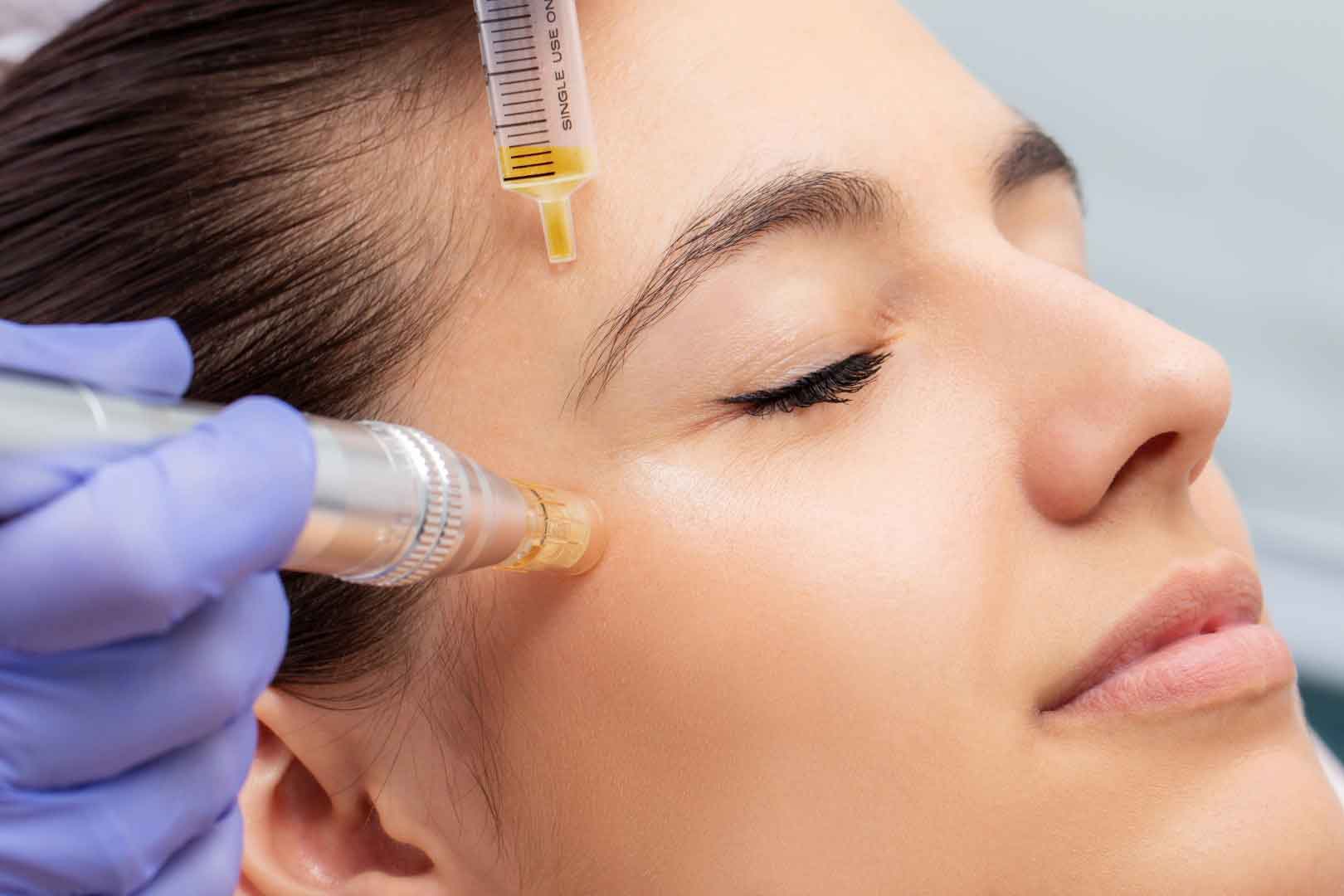 Mesotherapy clinic, Mesotherapy clinic in Pune, Mesotherapy clinic in Kharadi, Mesotherapy treatment in Kharadi, Mesotherapy treatment in pune, Mesotherapy treatment