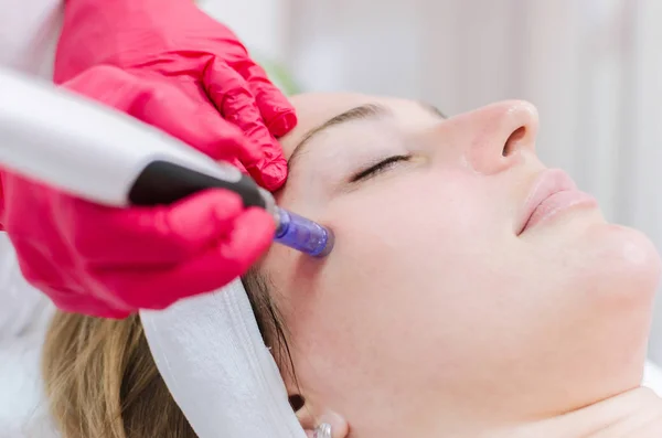 Microneedling treatment, Microneedling treatment in Pune, Microneedling treatment in Kharadi, Microneedling near me in pune, Microneedling near me in Kharadi, Microneedling near me